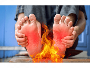 Calgary Neuropathy Association